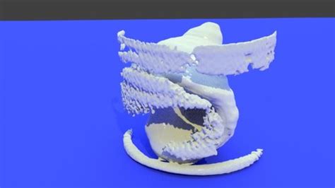 democratiz3d|dicom to stl software.